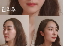 캠페인 썸네일